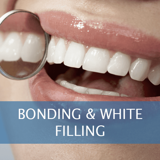 Bonding and White Filling Uxbridge, MA Dentist Dentist in Uxbridge, MA Uxbridge family Dental